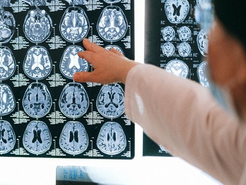 Neurologie Stellenangebote